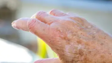 ¿Por qué se forman las manchas oscuras en las manos? ¿Por qué se forman las manchas oscuras en las manos?
