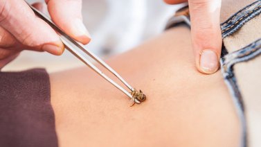 Apiterapia, una herramienta de la medicina alternativa