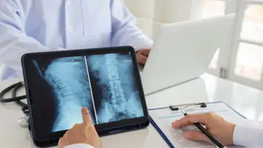 ¿Qué es la vertebroplastia? ¿Qué es la vertebroplastia?