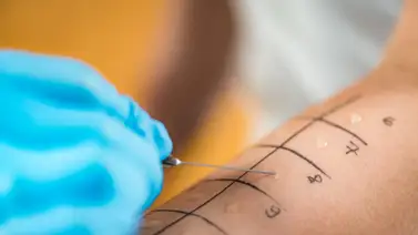 Pruebas para diagnosticar alergias Pruebas para diagnosticar alergias