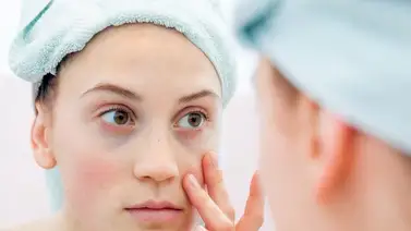 El Lupus, una enfermedad de gran incidencia en el mundo El Lupus, una enfermedad de gran incidencia en el mundo