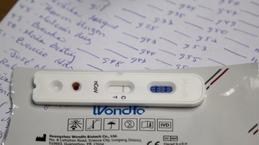 Hasta 90 dólares pagan los venezolanos por una prueba PCR