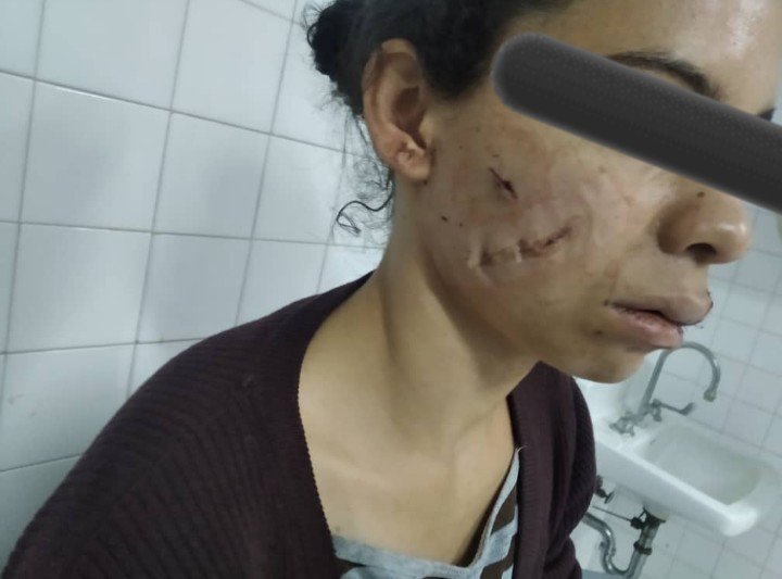 Buscan a un hombre que atacó y le desfiguró el rostro a su expareja en Miranda Buscan a un hombre que atacó y le desfiguró el rostro a su expareja en Miranda