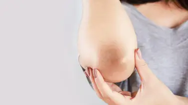 Solución casera para aclarar codos y rodillas Solución casera para aclarar codos y rodillas