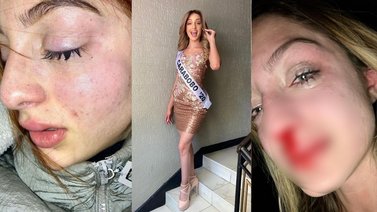 Carla Pachecho, la modelo venezolana agredida por su expareja