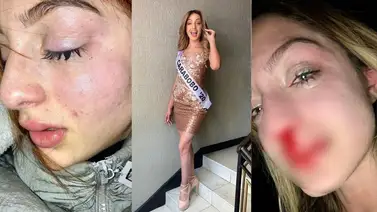 Carla Pachecho, la modelo venezolana agredida por su expareja Carla Pachecho, la modelo venezolana agredida por su expareja