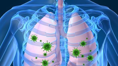 Conoce la bronquitis aguda o resfriado respiratorio