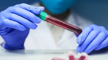 Especialista alerta repunte de casos de VIH-SIDA en jóvenes Especialista alerta repunte de casos de VIH-SIDA en jóvenes