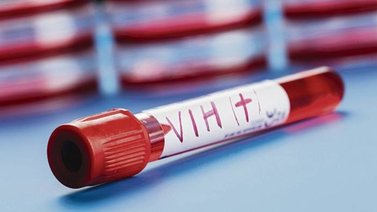 Organizaciones se dedican a la atención y prevención del VIH