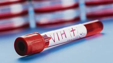 Organizaciones se dedican a la atención y prevención del VIH