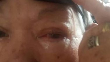 Servicio Público: Ayudemos a Cecilia a salvar su ojo