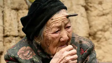 Así luce la mujer que le creció un cuerno de seis centímetros en la frente Así luce la mujer que le creció un cuerno de seis centímetros en la frente