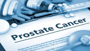 Especialista: Intervención temprana es clave para detener progresión de cáncer de próstata