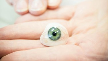 Una persona recibe la primera prótesis de ojo con tecnología 3D