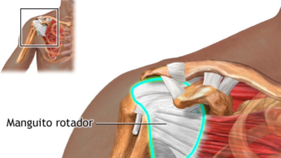 ¿Dolor en el hombro? Puede ser el manguito rotador ¿Dolor en el hombro? Puede ser el manguito rotador