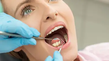 ¿Sabes si necesitas una limpieza dental? ¿Sabes si necesitas una limpieza dental?