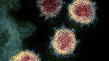 Científicos descubren un método para bloquear la infección del coronavirus