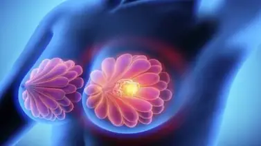 Servicio público| Ayudemos a Carmen Lavinia Duran a combatir el cáncer de mama Servicio público| Ayudemos a Carmen Lavinia Duran a combatir el cáncer de mama