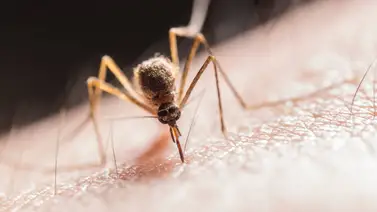 Síndrome de Skeeter: reacción alérgica a la picadura de mosquito Síndrome de Skeeter: reacción alérgica a la picadura de mosquito