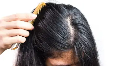 ¿Cómo controlar el cabello graso? ¿Cómo controlar el cabello graso?