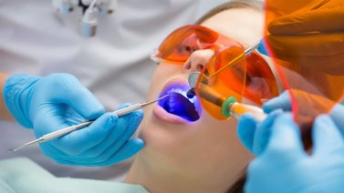 Tipos de blanqueamiento dental