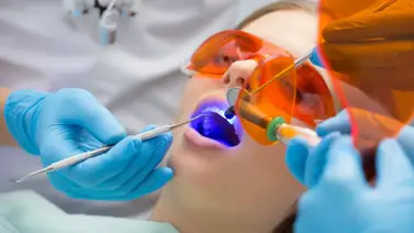 Tipos de blanqueamiento dental Tipos de blanqueamiento dental