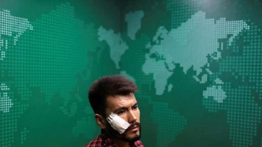 Talibanes atacaron con gran fuerza a dos periodistas afganos