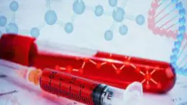 Solo la tercera parte de peruanos con hemofilia han sido diagnosticados Solo la tercera parte de peruanos con hemofilia han sido diagnosticados