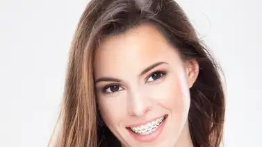 Cuida tu sonrisa es una aliada para la autoestima Cuida tu sonrisa es una aliada para la autoestima