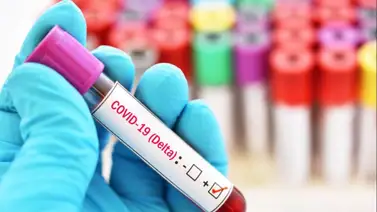 La variante Delta se encuentra presente en al menos 100 países La variante Delta se encuentra presente en al menos 100 países