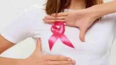 Estudio aconseja la reducción de un tratamiento contra el cáncer de mama Estudio aconseja la reducción de un tratamiento contra el cáncer de mama