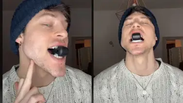 "Ejercitadores de mandíbula": La última moda en redes que pone en peligro la salud dental "Ejercitadores de mandíbula": La última moda en redes que pone en peligro la salud dental