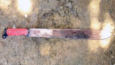 Mujer es atacada por su pareja con un machete Mujer es atacada por su pareja con un machete