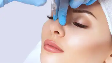 Rinomodelación: retoque nasal no invasivo Rinomodelación: retoque nasal no invasivo