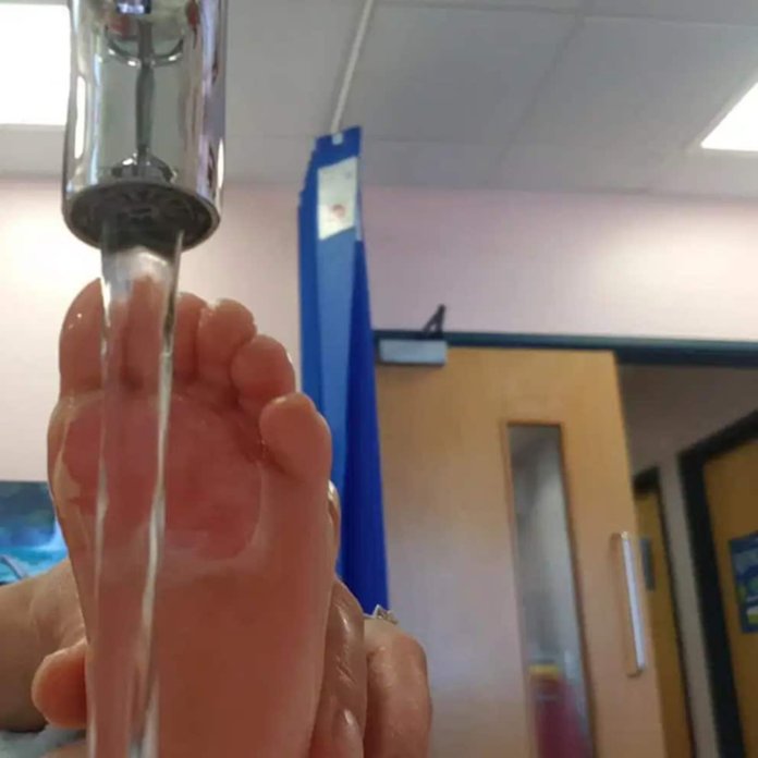 Un bebé se quema la piel de los pies en el piso de la cocina debido a fuerte ola de calor en Inglaterra Un bebé se quema la piel de los pies en el piso de la cocina debido a fuerte ola de calor en Inglaterra