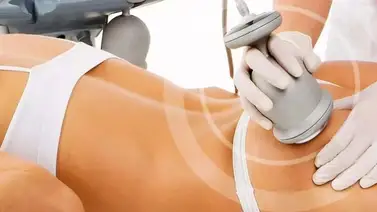 Vacumterapia: cuerpo escultural eliminando grasa Vacumterapia: cuerpo escultural eliminando grasa