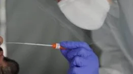 Estudio señala anticuerpos de la covid persistentes 9 meses tras infección