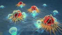 Se ha desarrollado una técnica no invasiva para detectar el cáncer