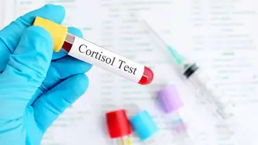 ¿Qué es el síndrome de Cushing? ¿Qué es el síndrome de Cushing?