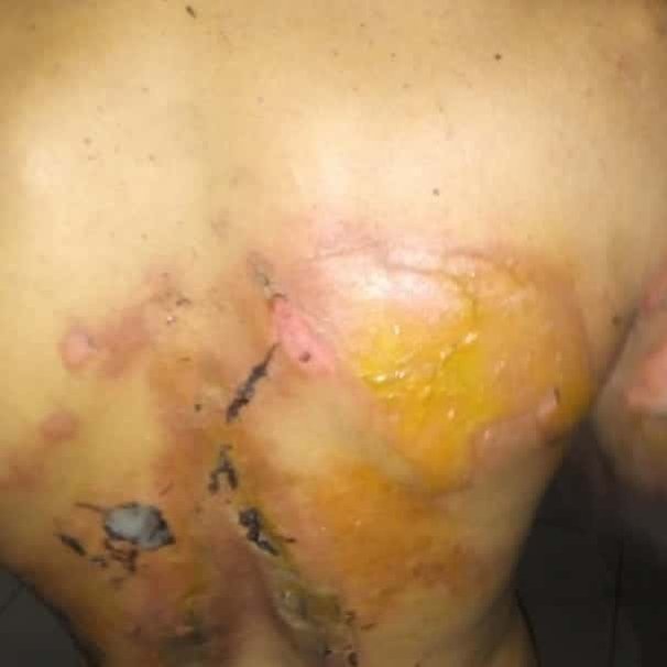 Trabajadores del Metro de Caracas resultan quemados tras una explosión en la estación Teatros (+Fotos)