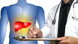 Hígado graso no alcohólico: causas y síntomas