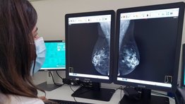 Revelan una nueva diana terapéutica para contrarrestar el cáncer de mama
