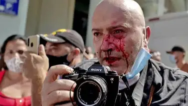Fotógrafo español es agredido durante cobertura de protestas en Cuba Fotógrafo español es agredido durante cobertura de protestas en Cuba
