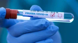 Países europeos rechazan PCR gratis para el certificado verde digital