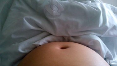 Encuentran extraña masa "humanoide" en el estómago de una joven