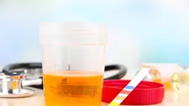 ¿Qué dice el color de la orina? ¿Qué dice el color de la orina?