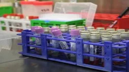 Identifican las moléculas que frenan la entrada del coronavirus en la célula
