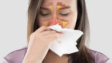 ¿Cómo combatir la sinusitis naturalmente? ¿Cómo combatir la sinusitis naturalmente?