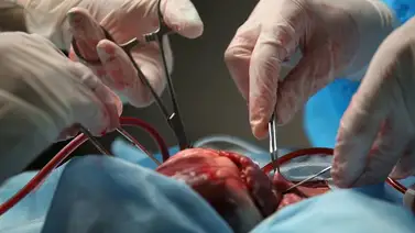 Italia trasplanta dos corazones de donantes COVID-19 con éxito Italia trasplanta dos corazones de donantes COVID-19 con éxito