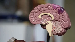 Día Internacional de los Tumores Cerebrales